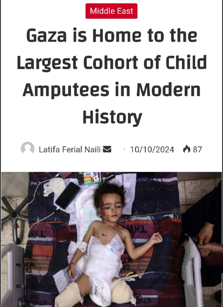 Gaza is the home of the cohort of children amputees in history. 