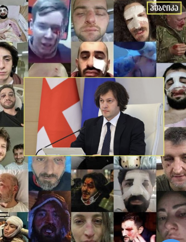 Photo of Georgian PM Khobakidze next to a flag of Georgia. The photo is surrounded by a montage of photos of Georgian protestors who have facial injuries from beatings by the police.