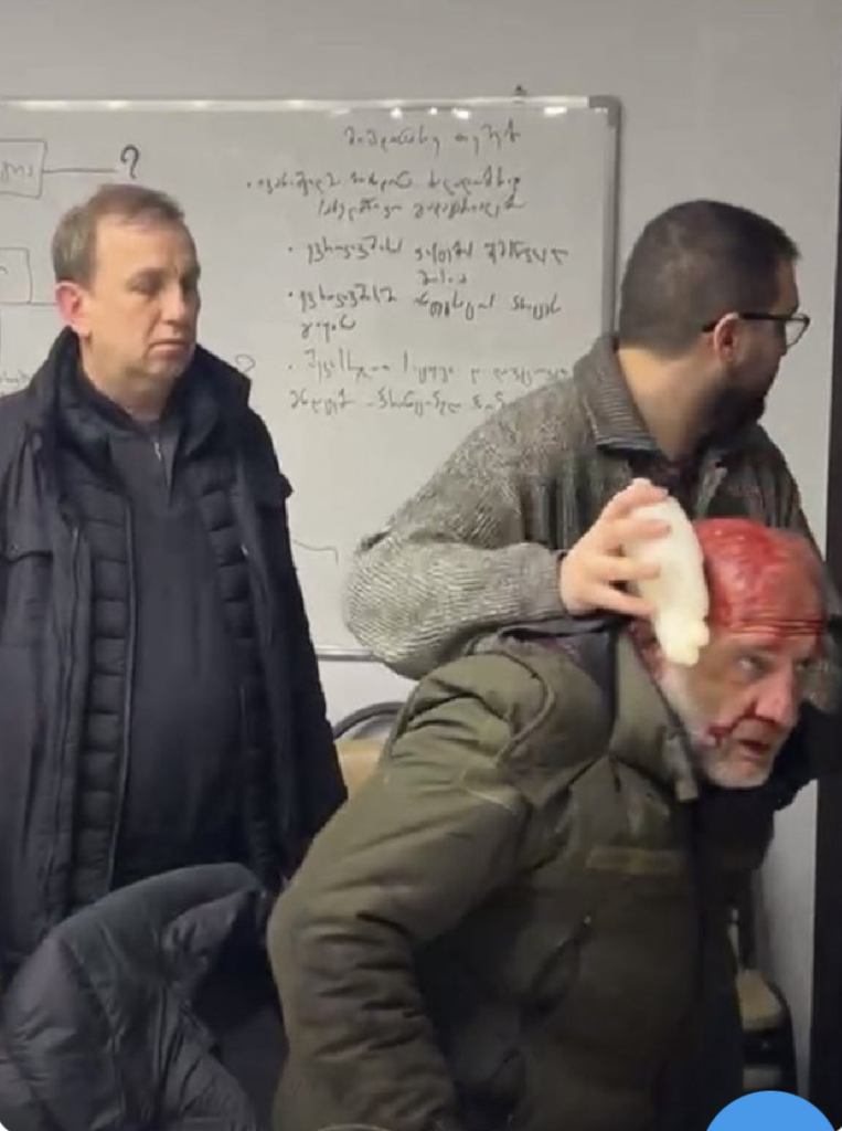 Bloodied injured politician in his office in Tbilisi Georgia.