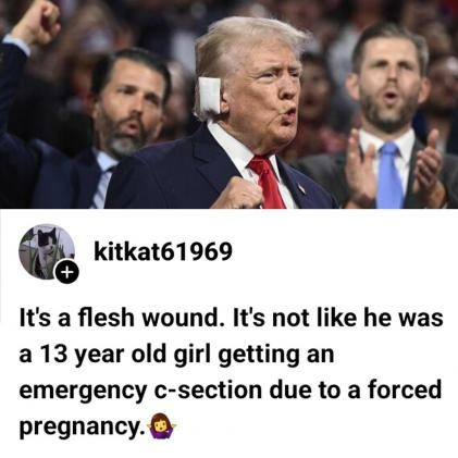 Horizontal color photograph.
Donald Trump Jr (left) howling like an ape and gesturing with his right arm, Donald Trump sucking air with a maxi pad on his ear (center), and Eric Trump (right) catching flies with his mouth while applauding at a campaign event.
Text below the image: kitkat61969
It's a flesh wound. It's not like he was a 13-year-old girl getting an emergency C-section due to a forced pregnancy.