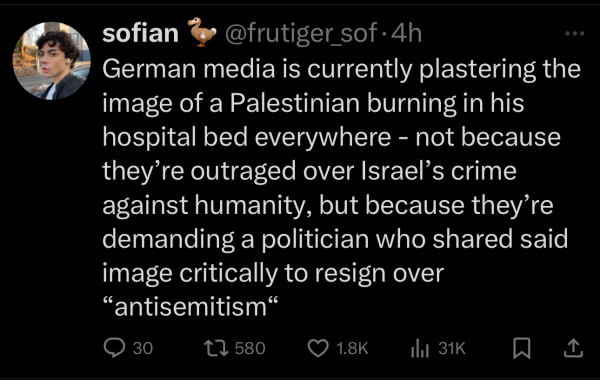 sofian
• @frutiger_sof•4h
German media is currently plastering the
image of a Palestinian burning in his
hospital bed everywhere - not because
they're outraged over Israel's crime
against humanity, but because they're
demanding a politician who shared said
image critically to resign over
"antisemitism"
• 30
< > 580
• 1.8K
1l 31K