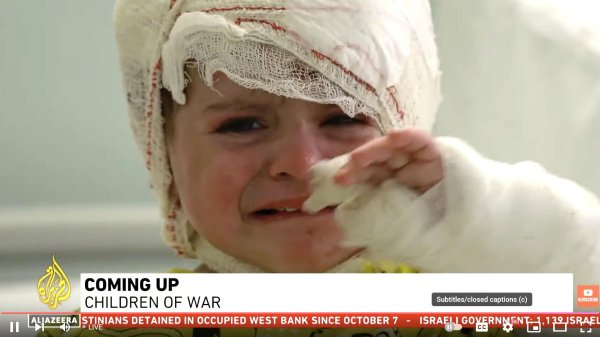 child in bandages, upset, victim of biden's enabling of israel's genocide 