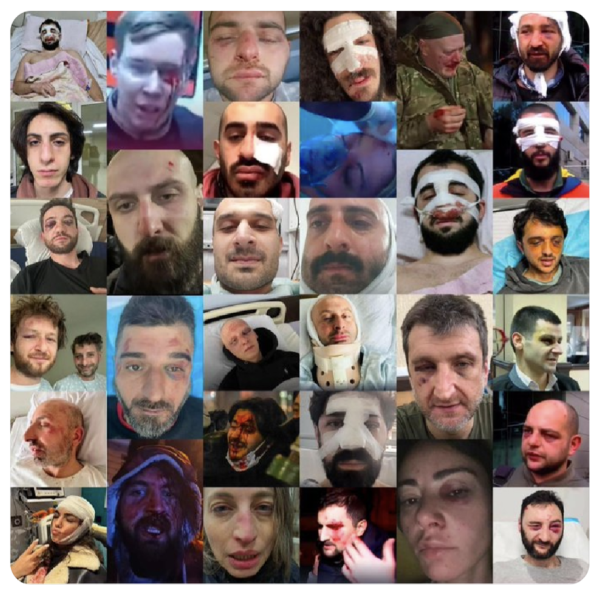 Photomontage showing dozens of Georgian protestors with severe facial injuries received from police brutality.