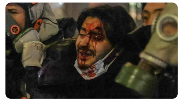 Aleksi Tirkia, injured in the forehead with blood all over his face.