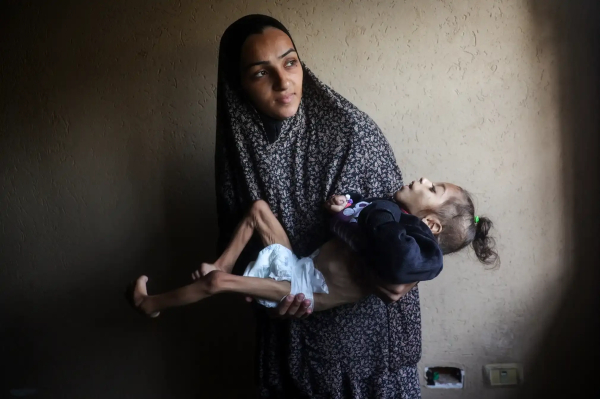 A woman holds her 5-year-old daughter who's suffering from malnutrition, Gaza, Eyad Baba