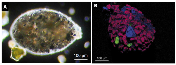 Picture on the left is shows a oval-shaped accumulation of sand grains with a glowing margin due to the microscopic lighting. The scale bar if 100 microns (on tenth of a millimetre). This is a living P. zirconia; intracellular mineral inclusions are visible. 
Picture on the right shows a roughly oval-shaped accumulation of sand, but in different shades of colour. Most of the grains are shaded red with prominent blue and green grains. This is an electron microscope imaging that has also measured the elemental composition of the grains. Minerals in pink are zircons, in green titanium oxides, in blue silicates and quartz.
(from Figure 3 and Figure 5 of Sabbatini et al 2016: https://www.researchgate.net/publication/299381635_Selective_zircon_accumulation_in_a_new_benthic_foraminifer_Psammophaga_zircona_sp_nov
